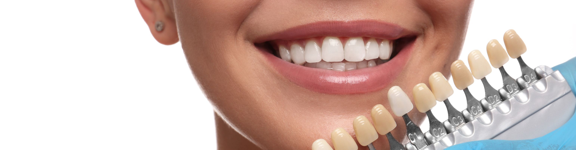 Gloved hands holding a tooth shade-matching tool next to a woman's smile.